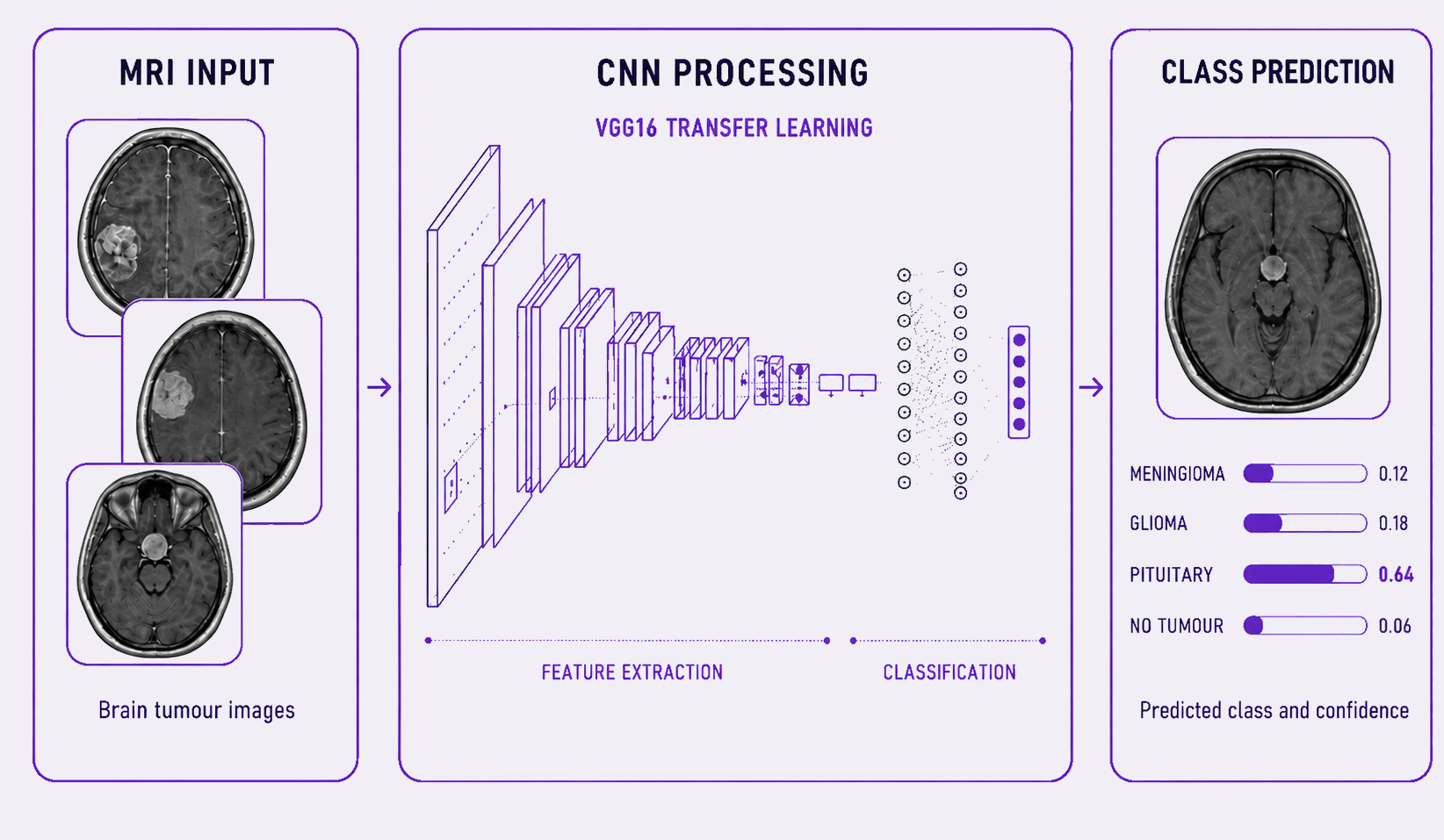 VGG16 transfer learning architecture used for MRI classification across four classes