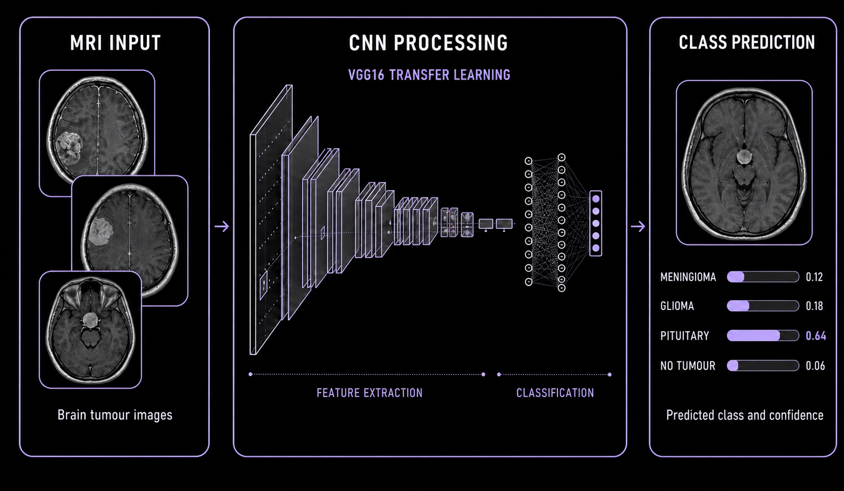 VGG16 transfer learning architecture used for MRI classification across four classes